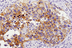 Immunohistochemistry Educational Series #6: IHC Nuts and Bolts