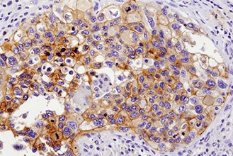 Immunohistochemistry Educational Series #6: IHC Nuts and Bolts