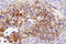 Immunohistochemistry Educational Series #6: IHC Nuts and Bolts