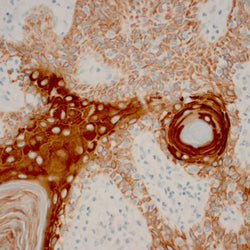 Immunohistochemistry Educational Series #1: Introduction to Immunohistochemistry