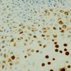 Immunohistochemistry Educational Series #5: In Situ Hybridization