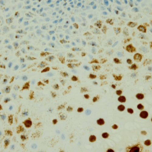 Immunohistochemistry Educational Series #5: In Situ Hybridization