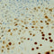 Immunohistochemistry Educational Series #5: In Situ Hybridization