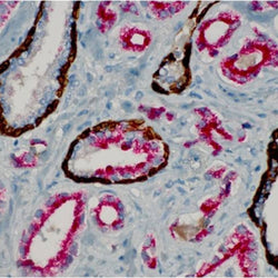 Immunohistochemistry Educational Series #3: Immunoperoxidase