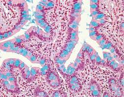Special Stains for Mucins