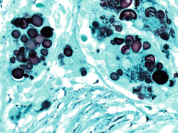 Fungal Stains