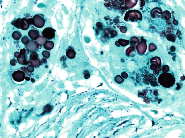 Fungal Stains