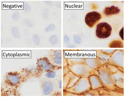 Immunohistochemistry (IHC) – Basics