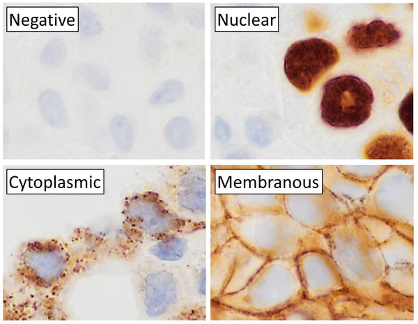Immunohistochemistry (IHC) – Basics