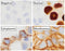 Immunohistochemistry (IHC) – Basics