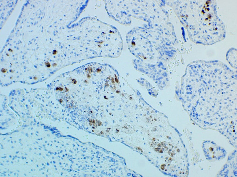 Control Slides, IHC - CMV Cytomegalovirus