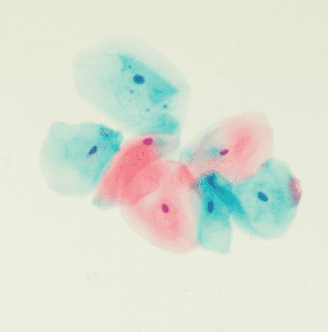 Gill 1 Hematoxylin