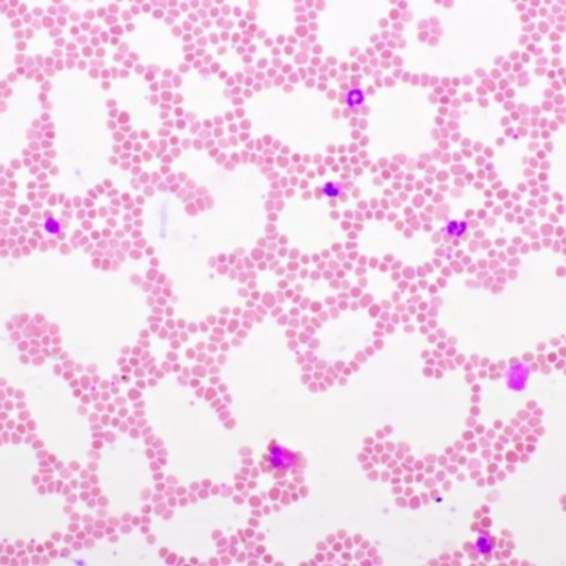 Hematology Stain Pack, Wright-Giemsa