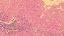 Gill 2 Hematoxylin