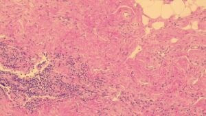 Gill 2 Hematoxylin