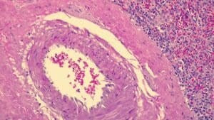 Gill 3 Hematoxylin