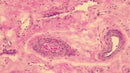 Mayer's Hematoxylin, Acidified