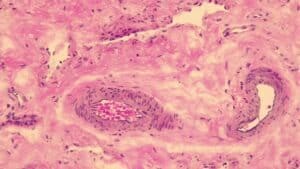 Mayer's Hematoxylin, Acidified