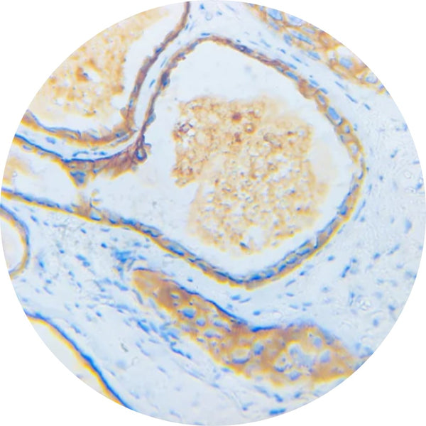 Control Slides, Her2 (2 pieces of tissue)