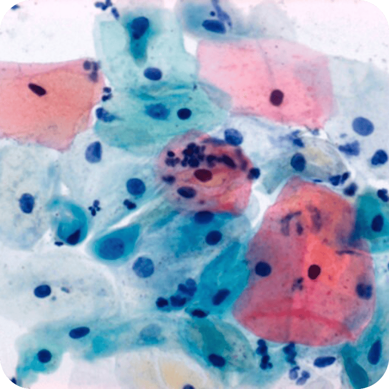 EA-36 Papanicolaou Stain