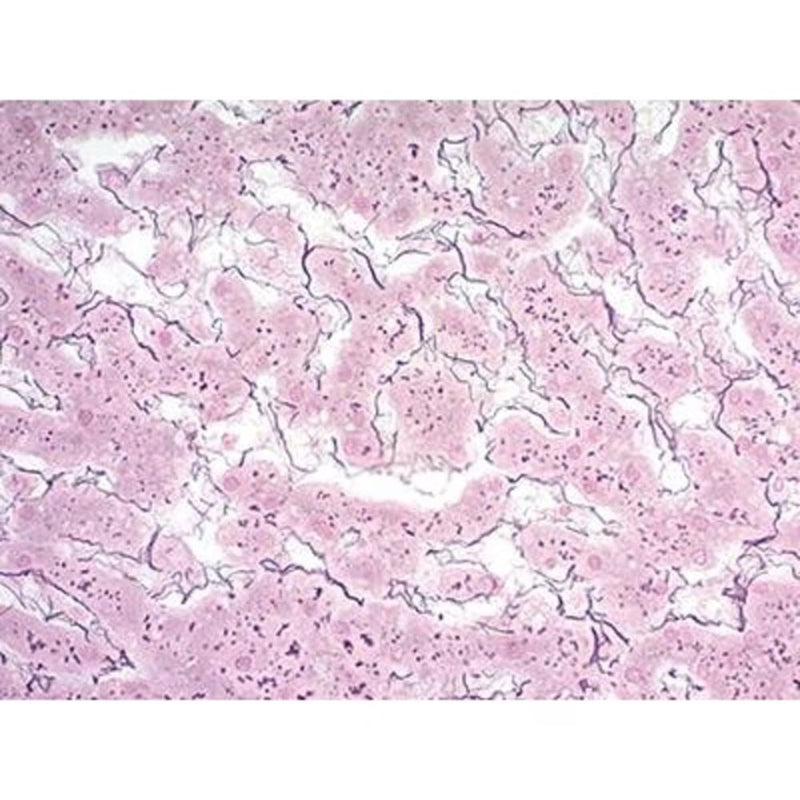 Reticulum Stain Kit (Brenn)
