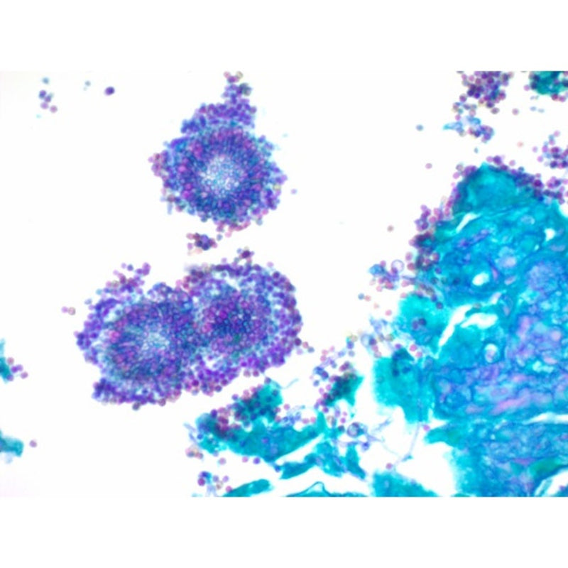 PAS Stain Kit, for Fungus, Volume Optimized