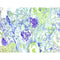 Pneumocystis Stain Kit, Volume Optimized