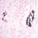 Calcium Stain Kit, (Modified Von Kossa), Volume Optimized