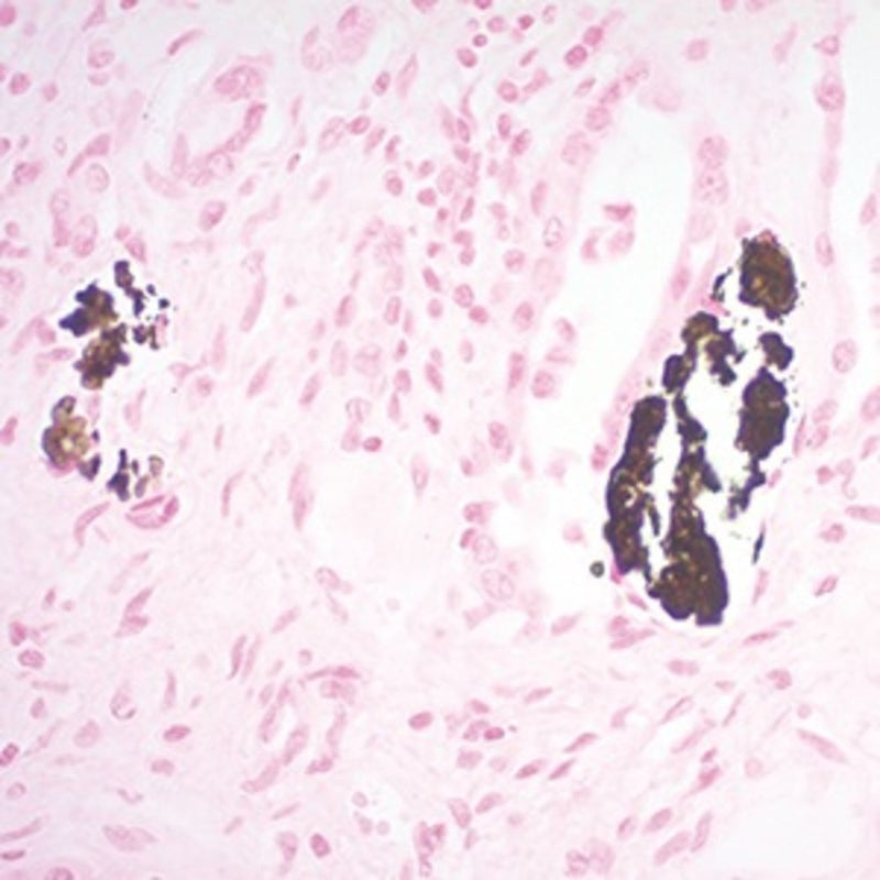Calcium Stain Kit, (Modified Von Kossa), Volume Optimized