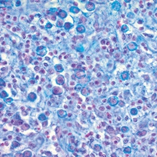 Eosinophil -Mast Cell Stain Kit, Volume Optimized