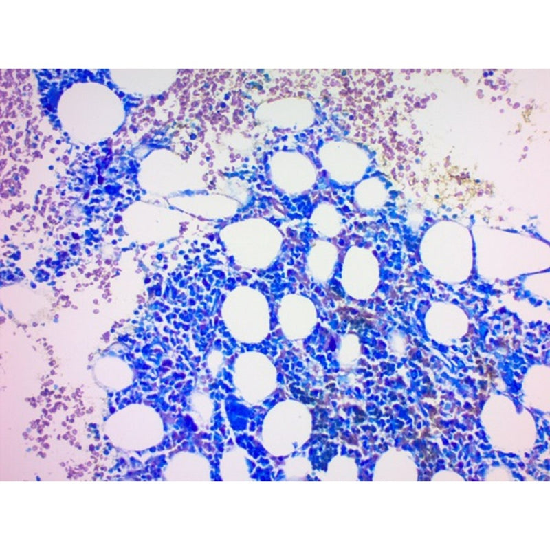 Giemsa Stain Kit (May-Grunwald) Volume Optimized