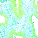 H. Pylori Stain Kit, Alcian Yellow, Volume Optimized