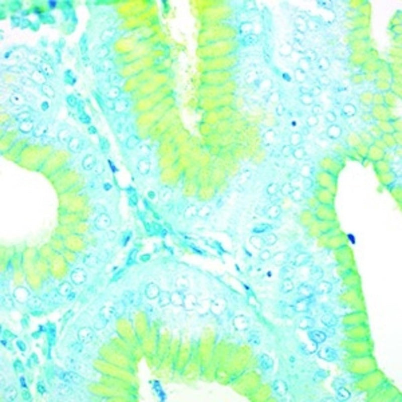 H. Pylori Stain Kit, Alcian Yellow, Volume Optimized
