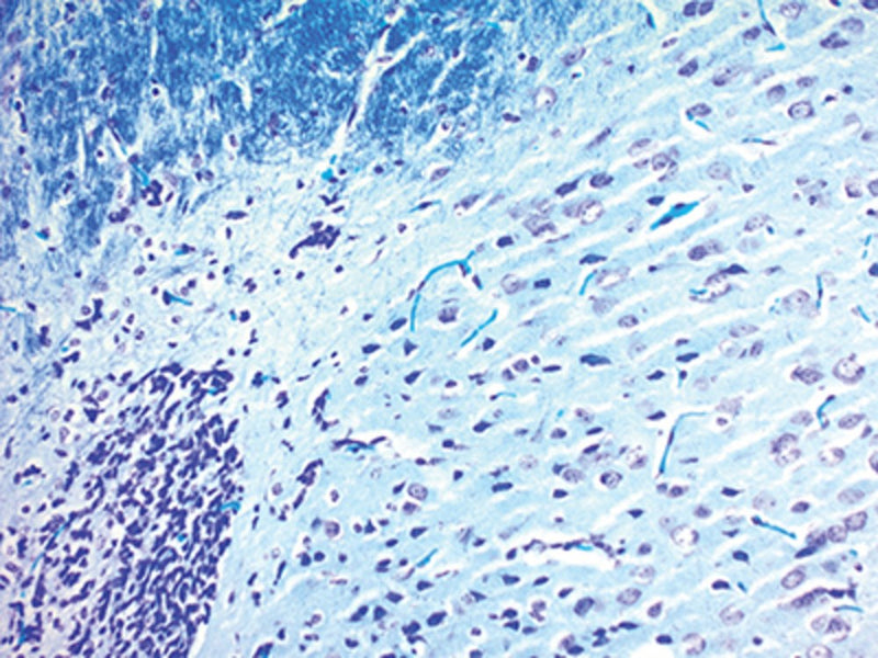 Luxol Fast Blue Stain Kit, Volume Optimized