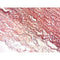 Orcein Stain Kit, Hepatitis B, Volume Optimized
