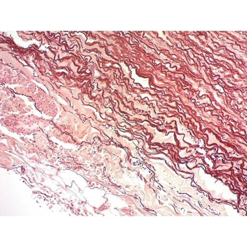 Orcein Stain Kit, Hepatitis B, Volume Optimized