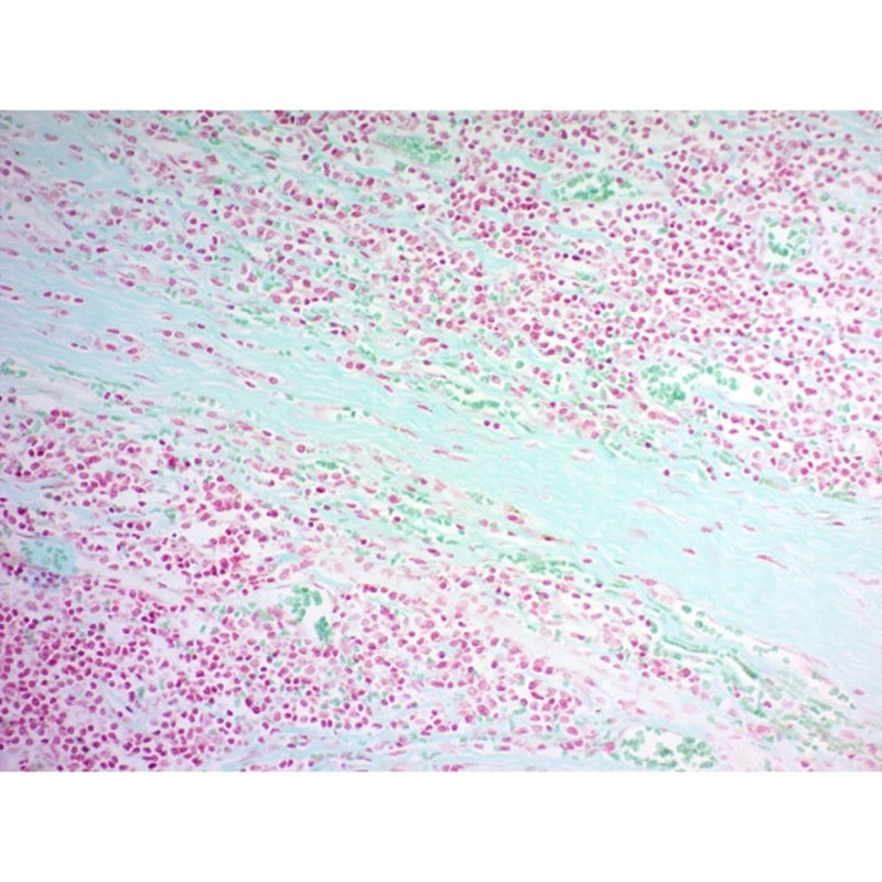 Twort's Counterstain Kit, Volume Optimized