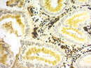 Warthin-Starry Stain Kit, Volume Optimized