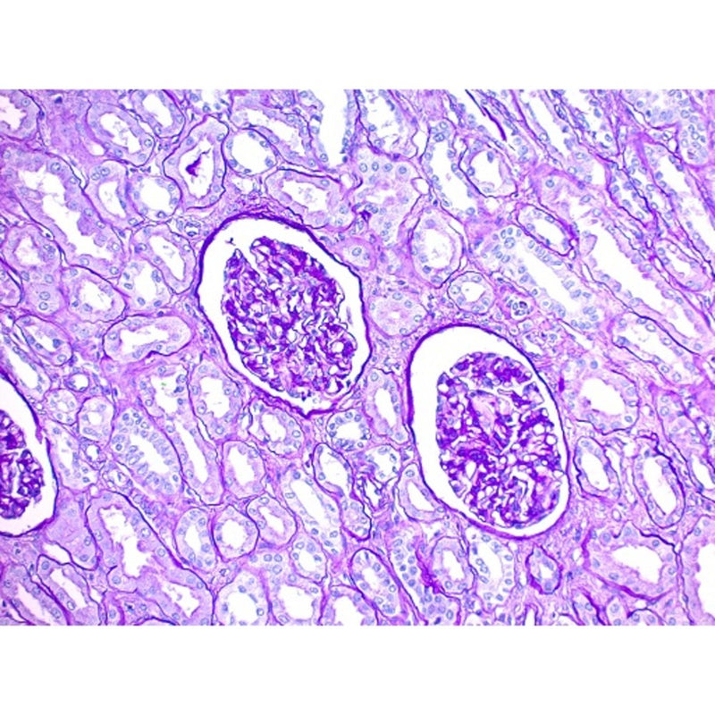PAS Stain Kit, (Modified Lillie's), Volume Optimized