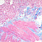 Trichrome Stain Kit, Masson Aniline Blue, Volume Optimized