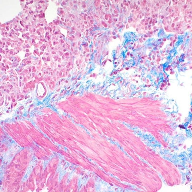 Trichrome Stain Kit, Masson Aniline Blue, Volume Optimized