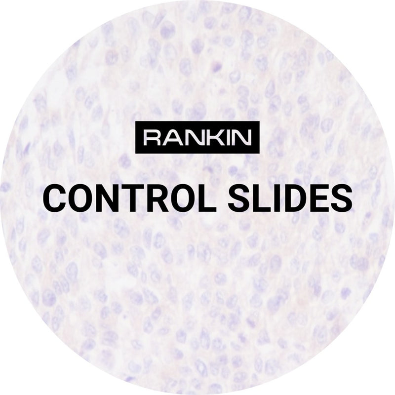 Control Slides, IHC - MUC4
