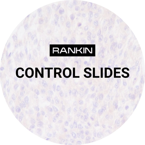Control Slides, IHC - Total Rb