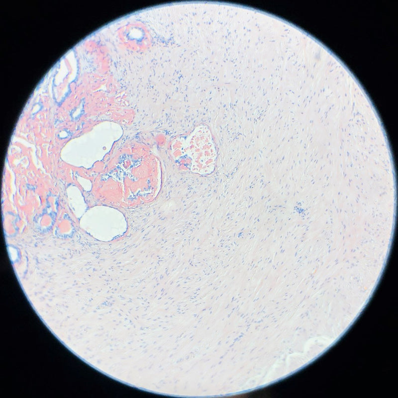 Rankin Basics Control Slides,  Special Stain - amyloid; congo red stain