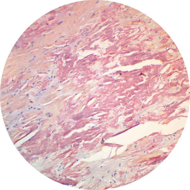 Rankin Basics Control Slides,  Special Stain - amyloid; congo red stain
