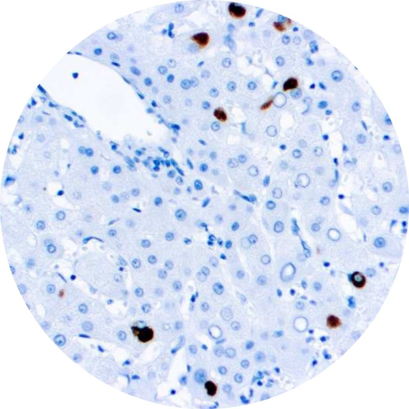 Rankin Basics Control Slides, Special Stain - hepatitis B; Orcein stain