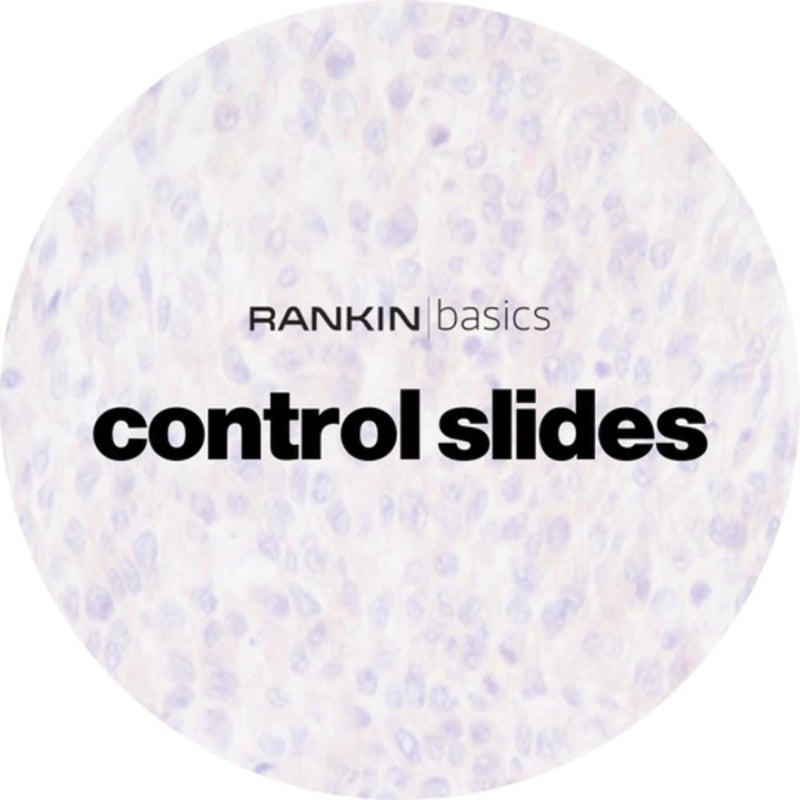 Rankin Basics Control Slides, Special Stain - mast cells; Toluidine Blue