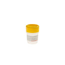 SIMPORT URINE SPECIMEN CONTAINERS - Urine Container, 60mL, Non-Sterile, 500/cs (20 cs/plt)