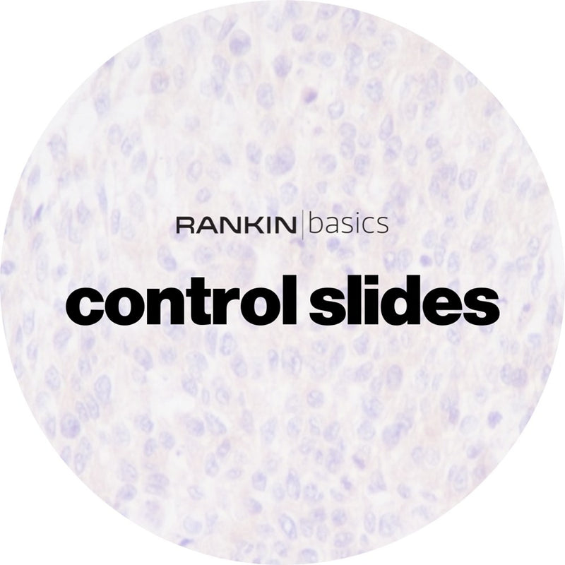 Rankin Basics Control Slides, IHC - Tryptase