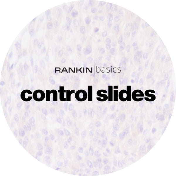 Rankin Basics Control Slides, IHC - NT5E